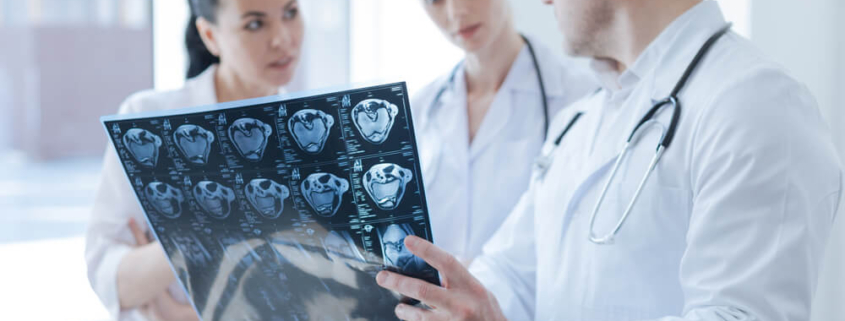Should You See a Neurologist After a Head Impact