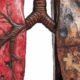 How Long Does the Black Lung Claims Process Take?